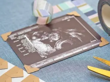 Ein Ultraschallbild eines Babys wurde mit braunen Fotoecken auf dem Cover eines Leinen-Fotoalbums von Goldbuch befestigt. Foto: Johanna Rundel