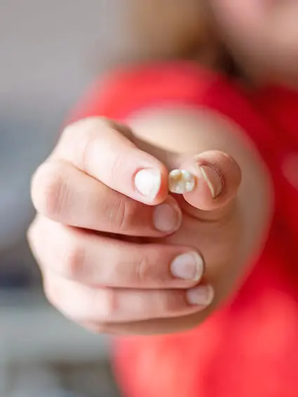 Ein Kind in einem roten T-Shirt hält einen ausgefallenen Wackelzahn in die Kamera. Foto: Johanna Rundel